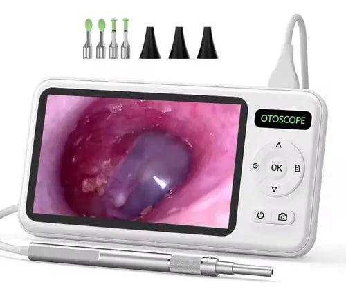 Otoscopio Digital 1080P HD de 3.9 mm Recargable | Grado B