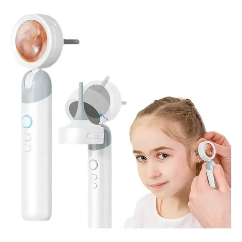 Otoscopio Digital 1080P HD de 3.9 mm Recargable | Grado B